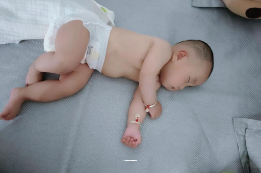 泰安六个月宝宝眼睛散光